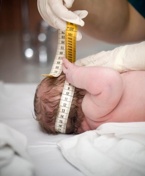 Infant head circumference