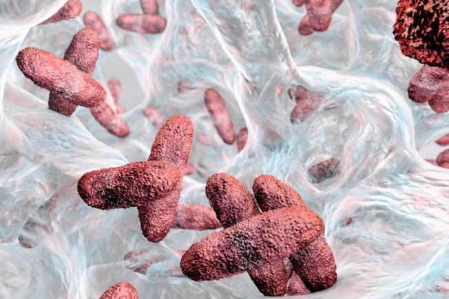 Klebsiella biofilm