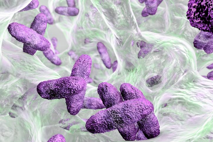 Klebsiella