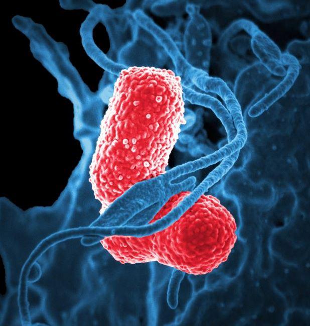 Klebsiella pneumoniae
