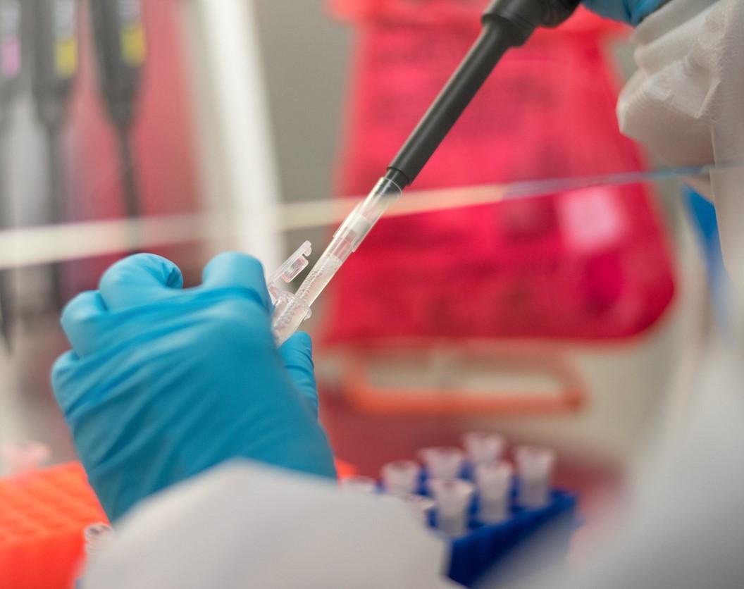 Lab research