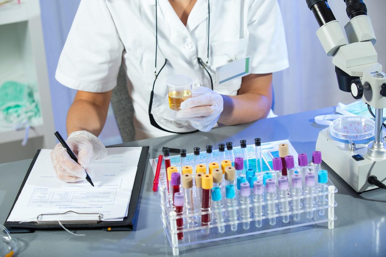 Lab technician conducting urinalysis