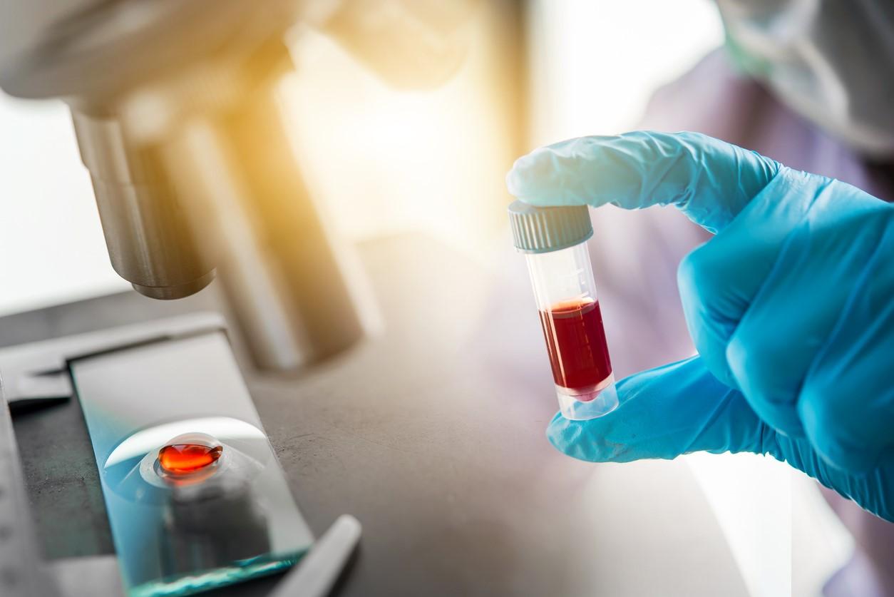 Lab blood testing