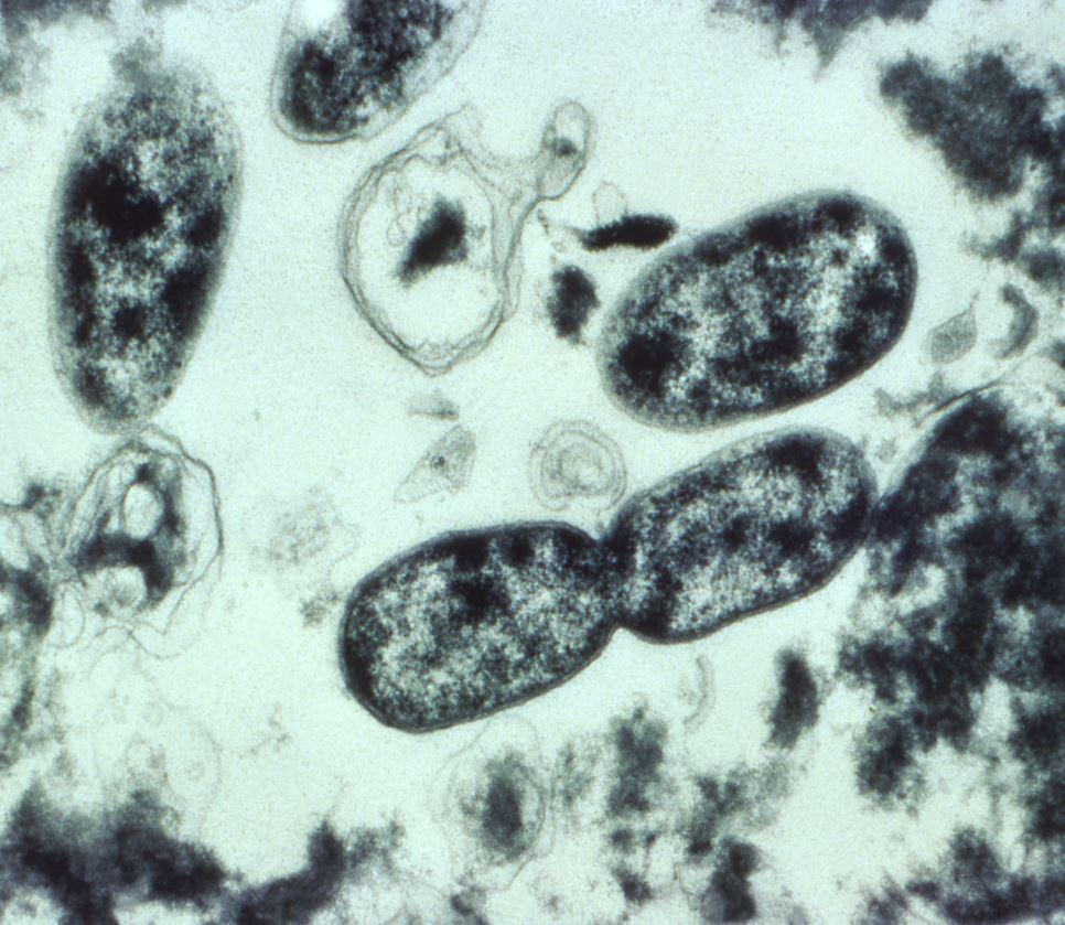 Legionella bacteria under microscope