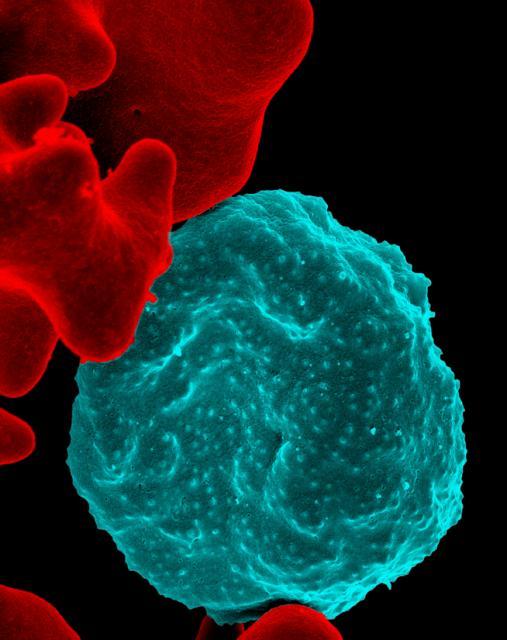 Malaria-infected red blood cell