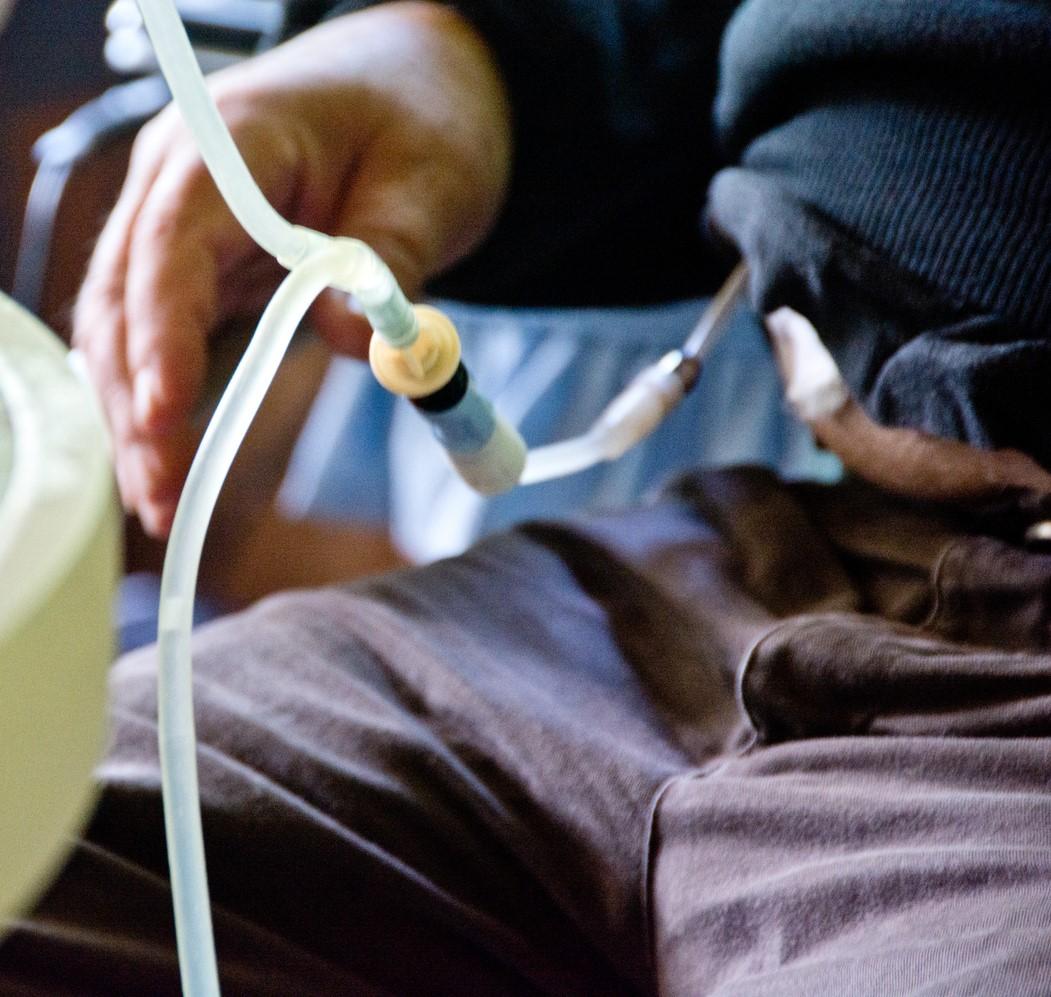 Man undergoing dialysis