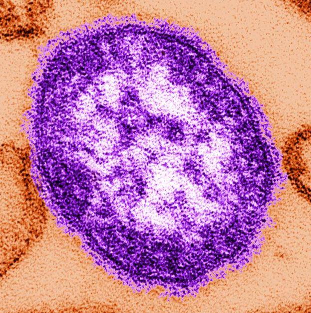 Measles virion
