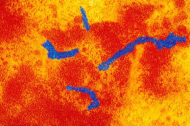 Measles virus