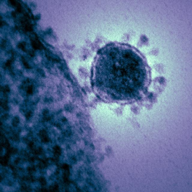 Micrograph of MERS virus