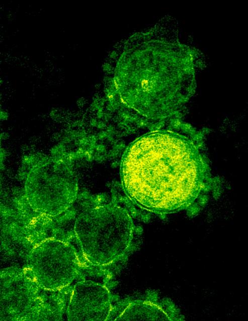 Micrograph of MERS-CoV