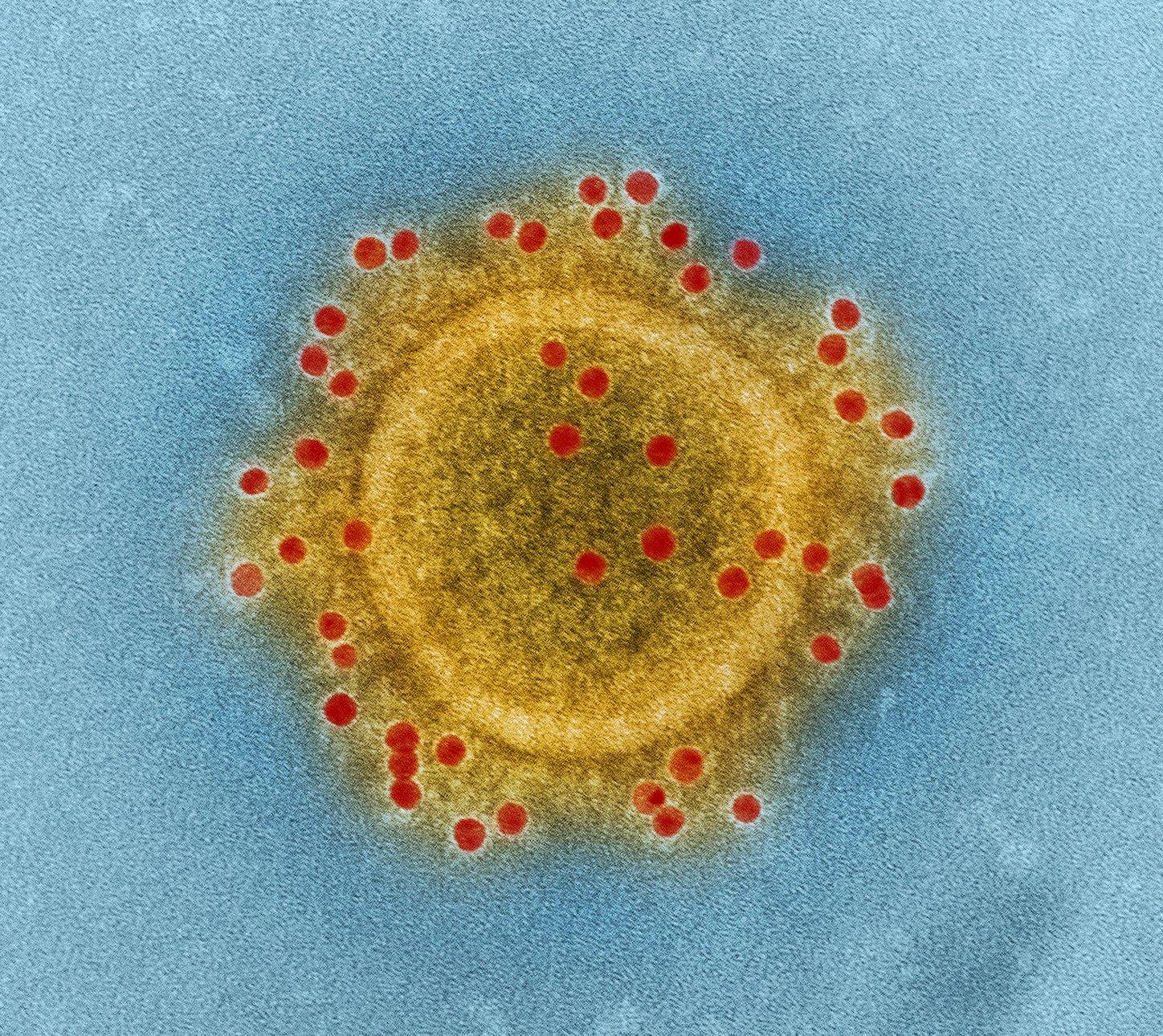MERS virus