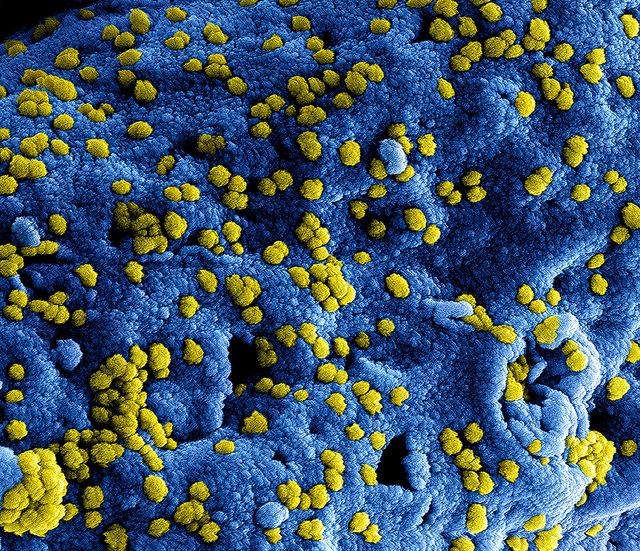 MERS-CoV particles