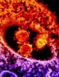 MERS-CoV micrograph