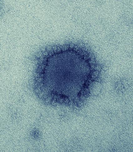 Negative stain electron microscopy of a MERS-CoV particle
