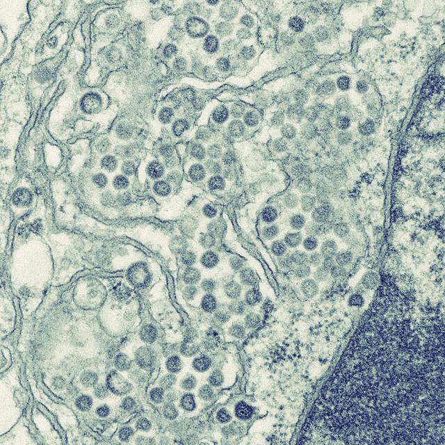 An electron micrograph of a thin section of MERS-CoV