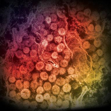 MERS-CoV in cytoplasm