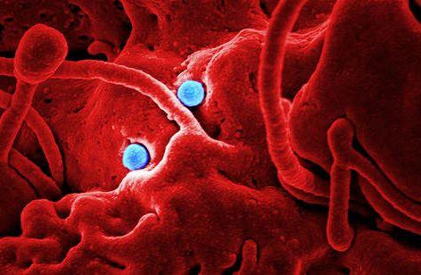 MERS particle