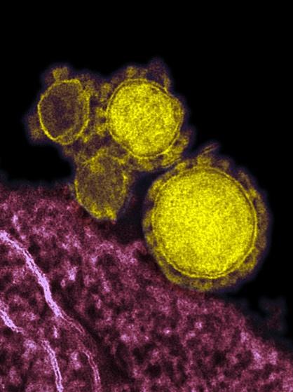 MERS virus