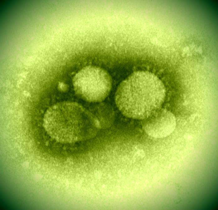 MERS virus
