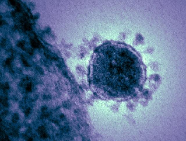 MERS virus