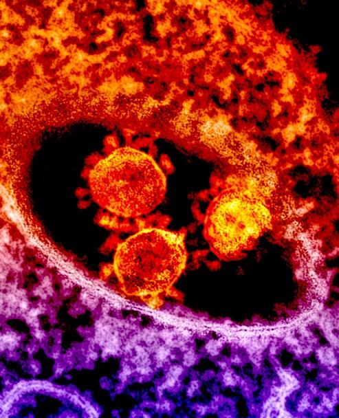 MERS virus