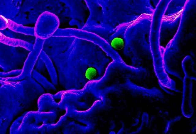 MERS virus particles