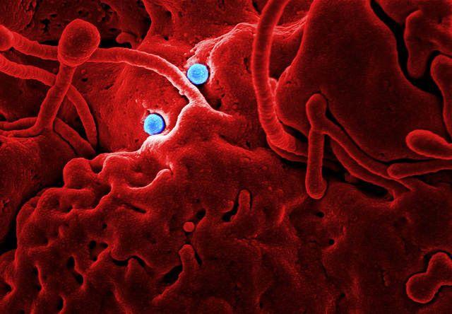 MERS virus particles