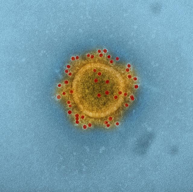 MERS virus