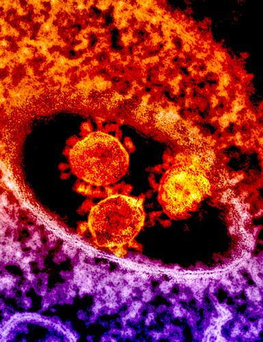 MERS virus