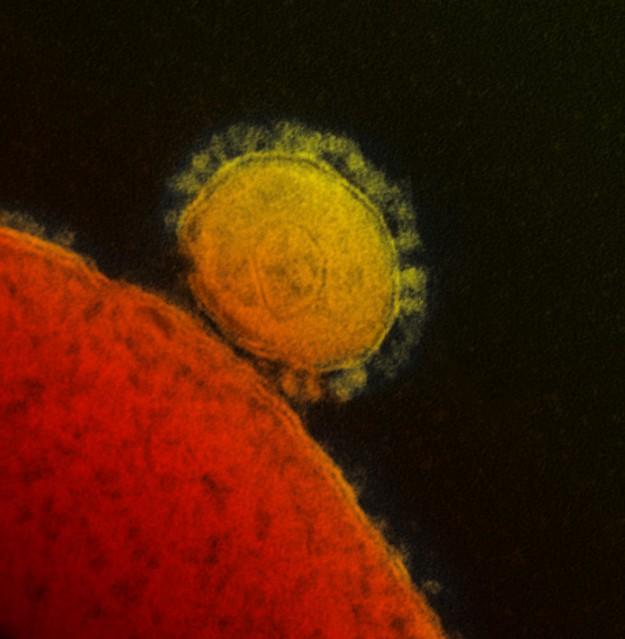 MERS virus