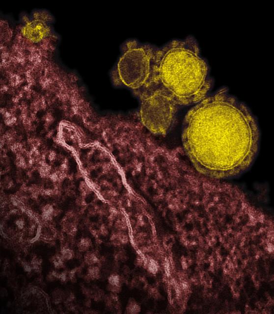 MERS virus