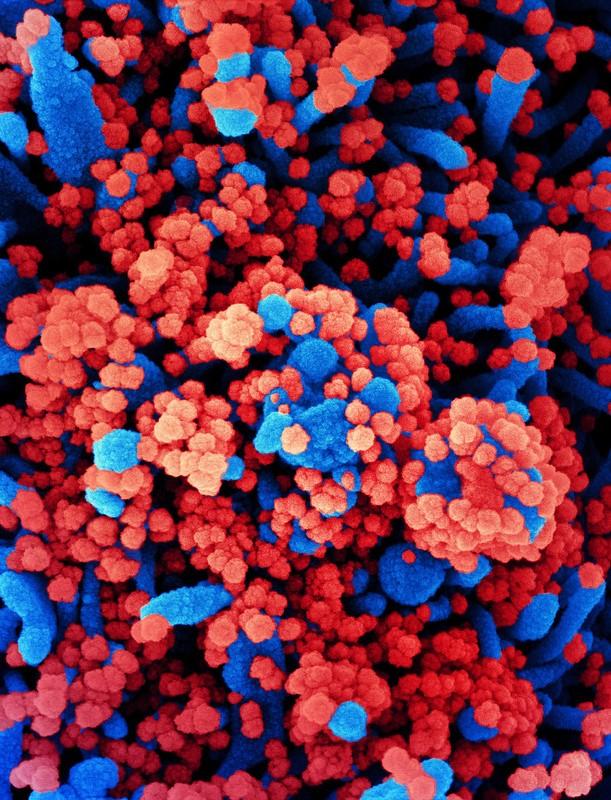 Magnified view of COVID-19 viruses