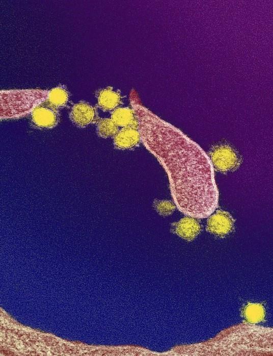 SARS-CoV-2 viruses under the microscope