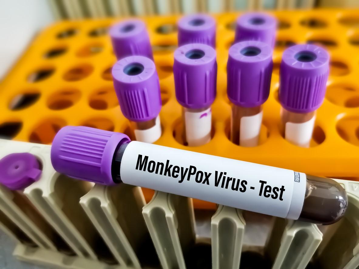 Monkeypox blood test