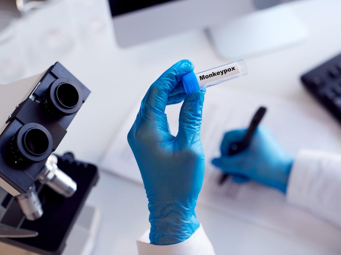 Monkeypox lab researcher