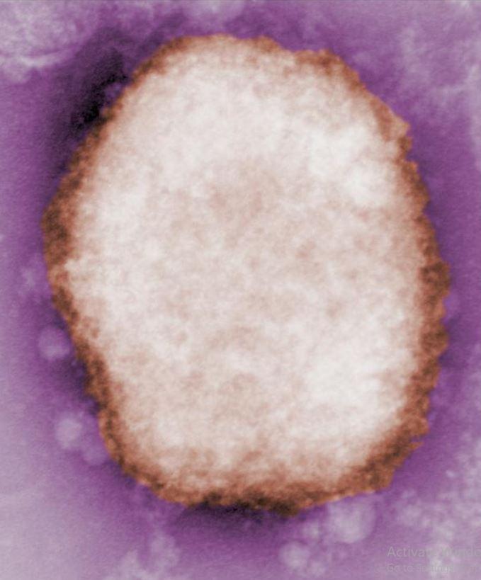 Monkeypox virus under microscope