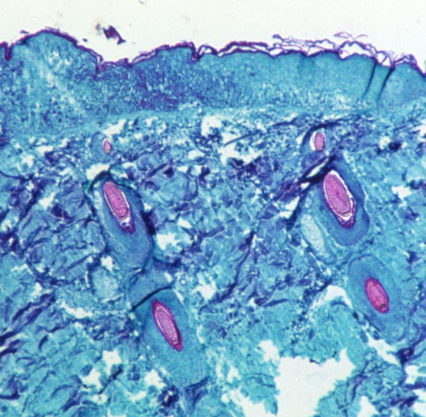 Monkeypox viruses under the microscope