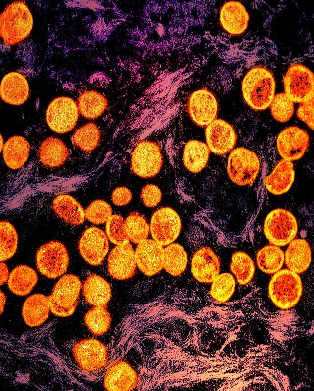 Monkeypox viruses under the microscope