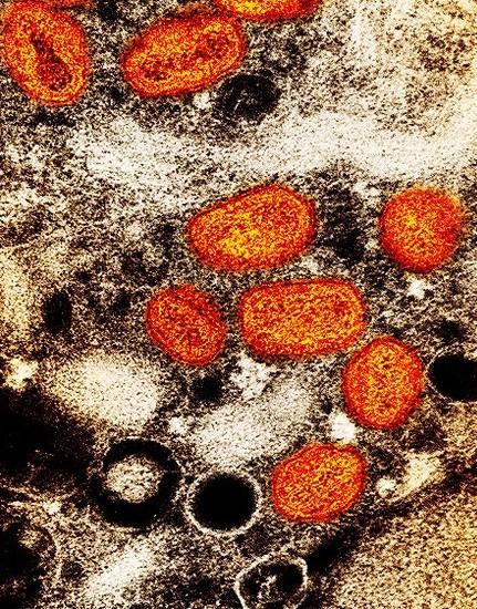 Monkeypox viruses under the microscope