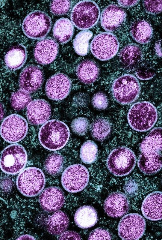 Monkeypox viruses under microscope