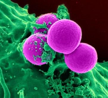 MRSA