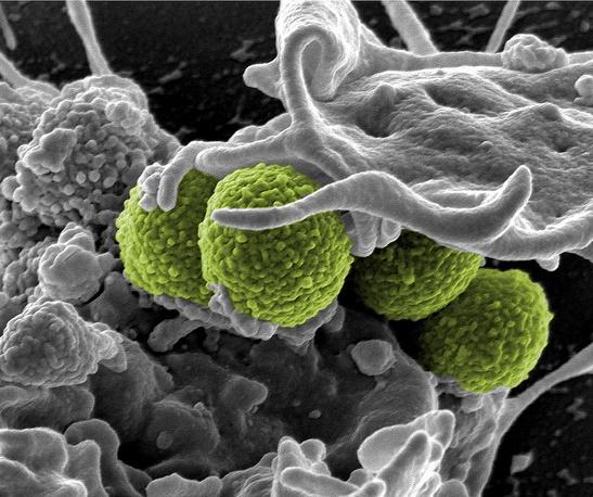 Methicillin-resistant Staphylococcus aureus. Credit: NIAID