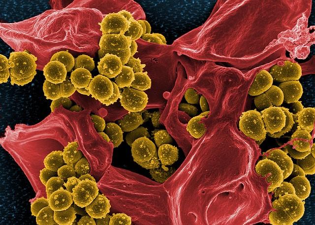 MRSA