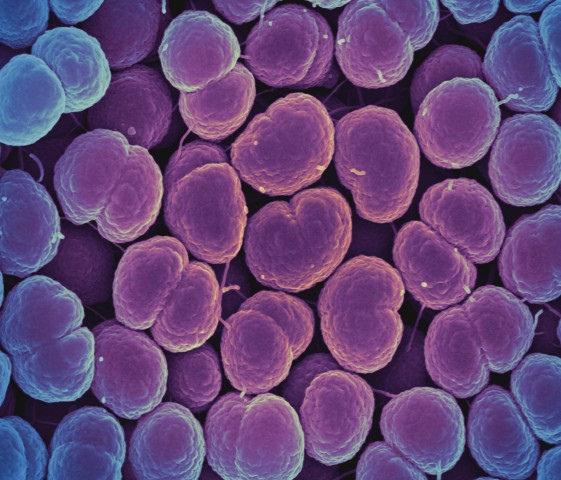 N gonorrhea