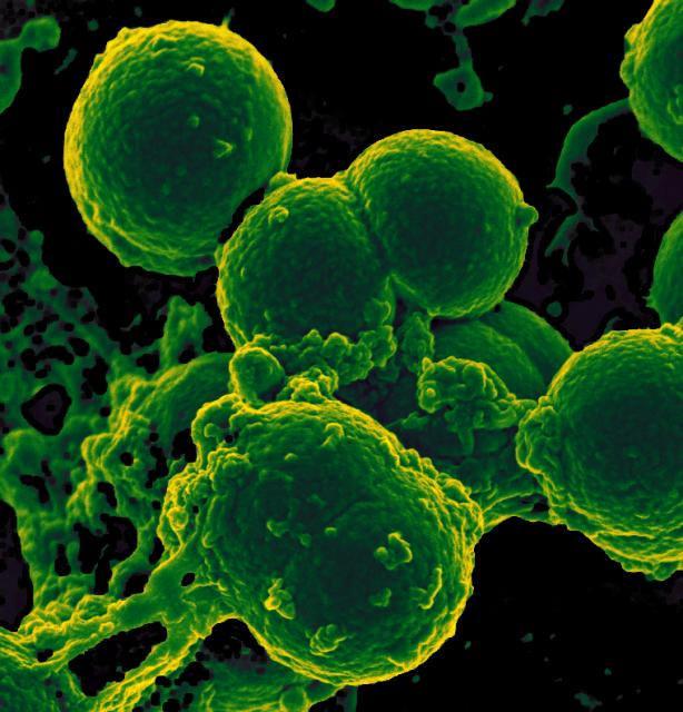 Neutrophil ingesting MRSA