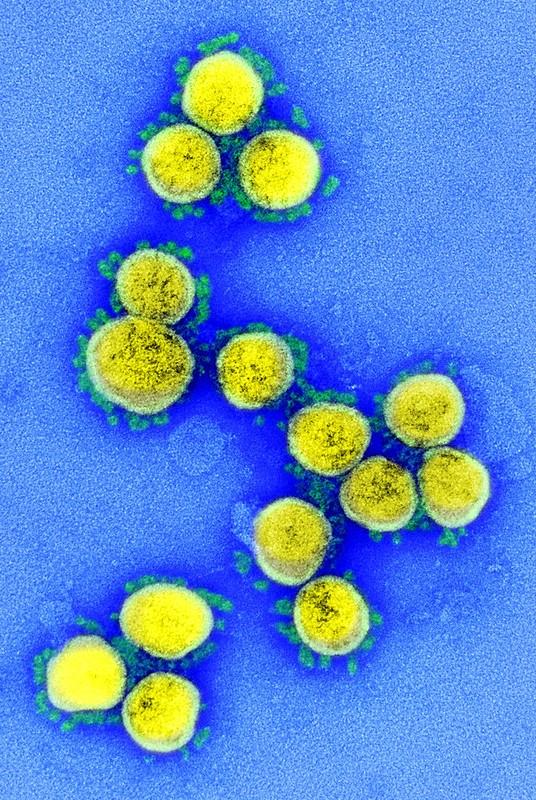 SARS-Cov-2 viruses under microscope