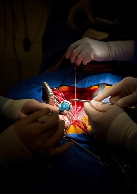 Open heart surgery