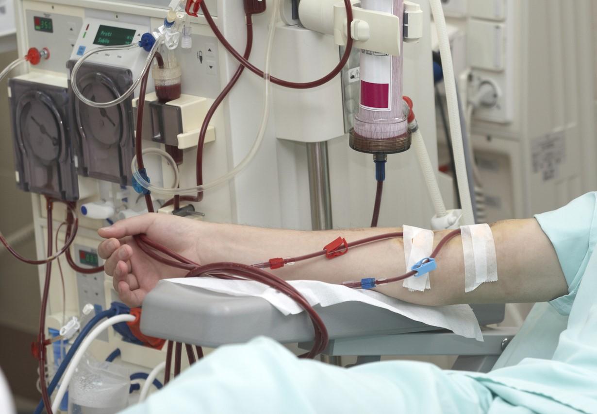 Patient getting dialysis treatment