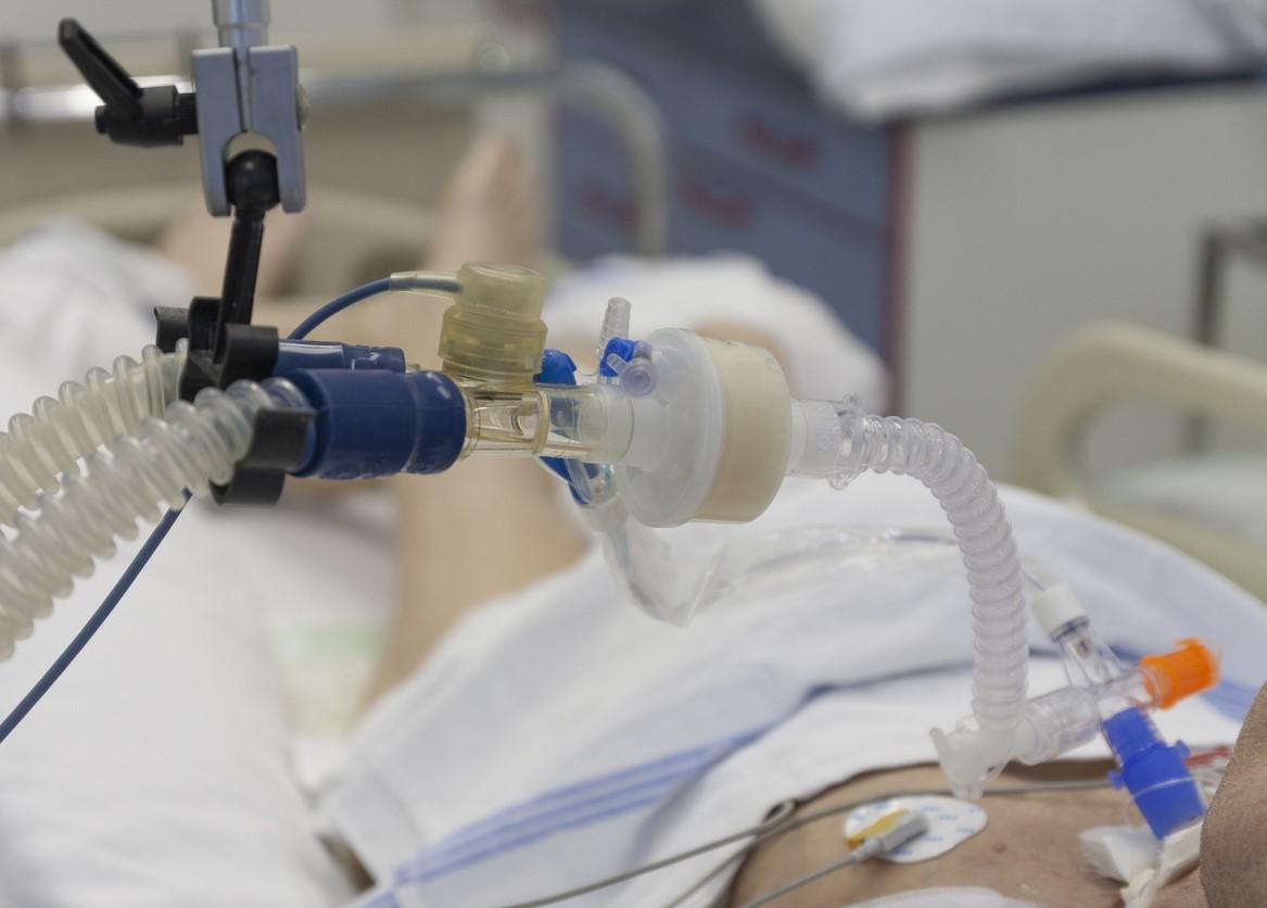Patient on ventilator