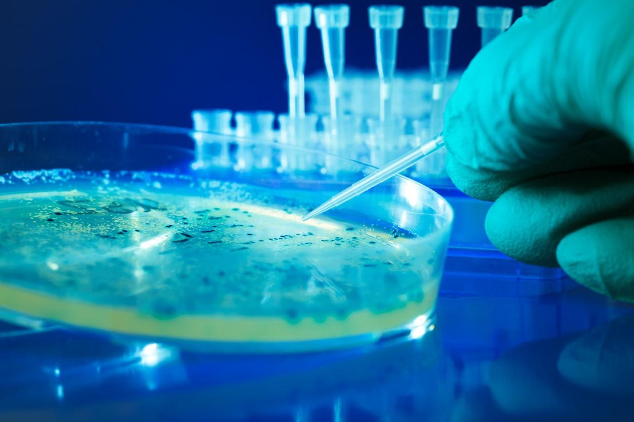 Petri dish with bacteria cultures